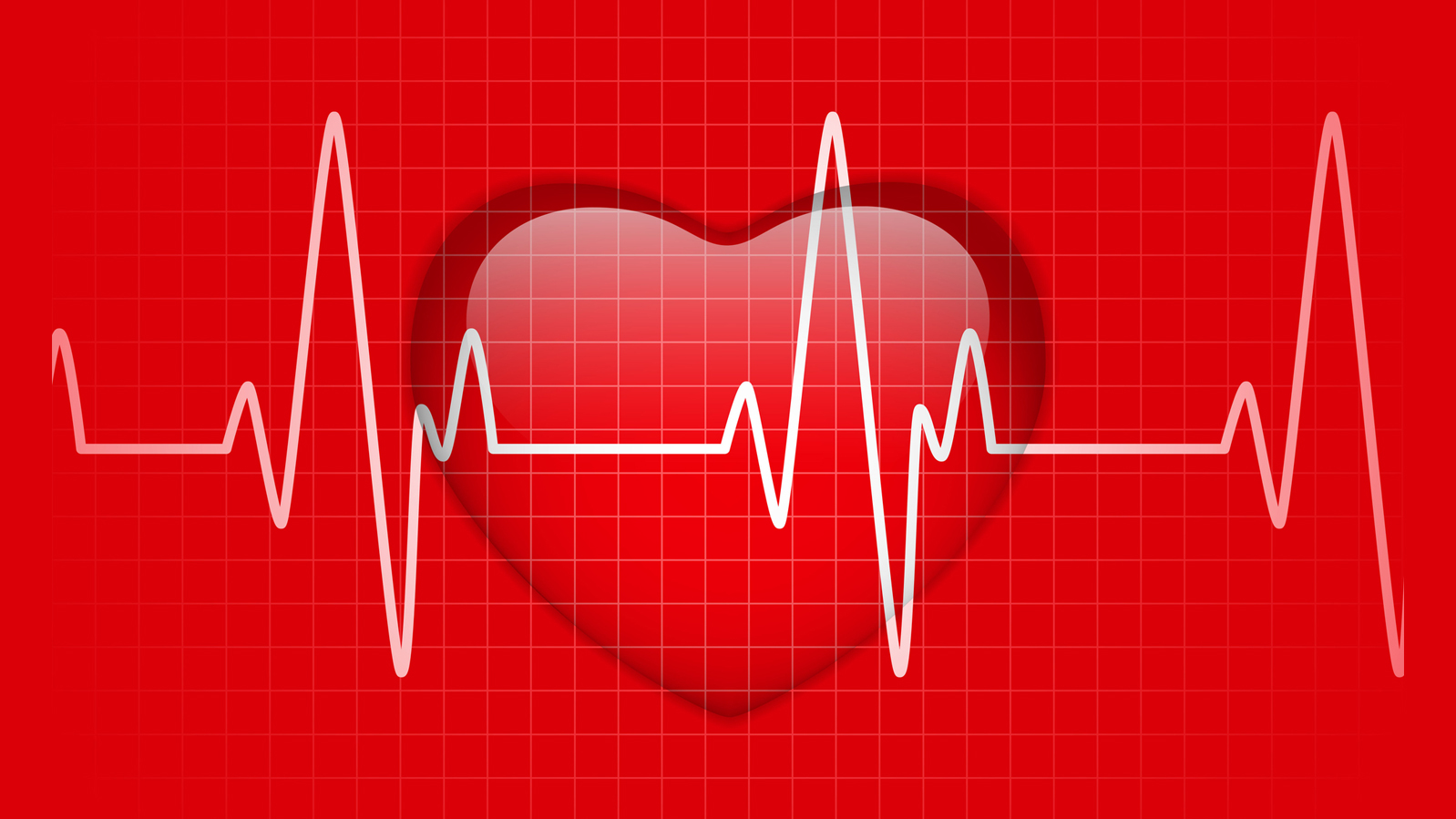 Got Rhythm? Atrial Fibrillation and its Effect on Your Health