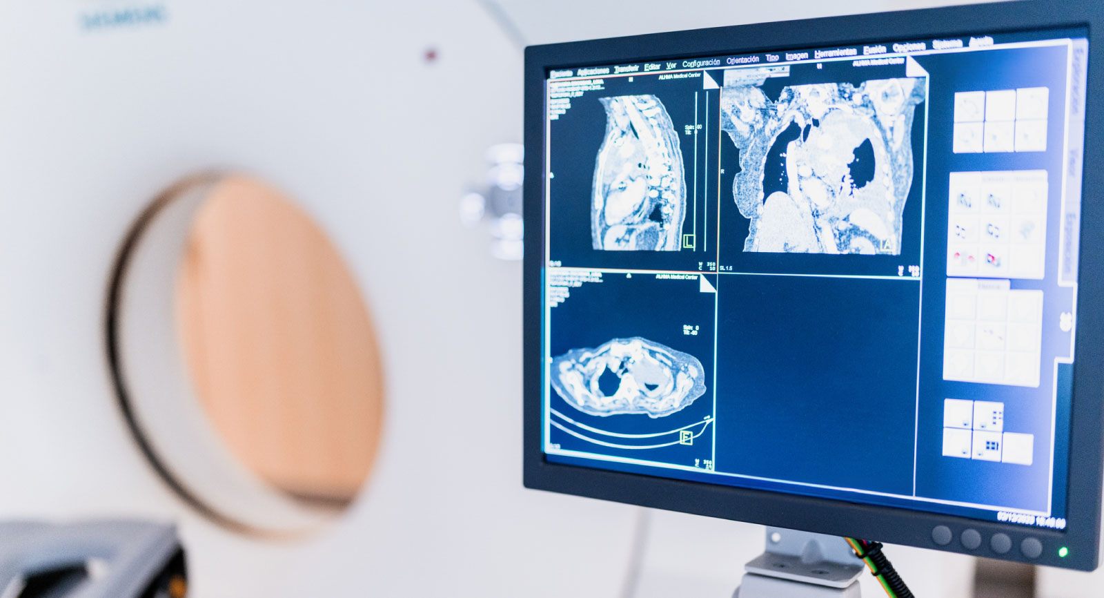CT Scanner with scanned images
