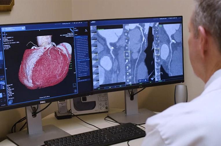 man looking at organs on computer screen