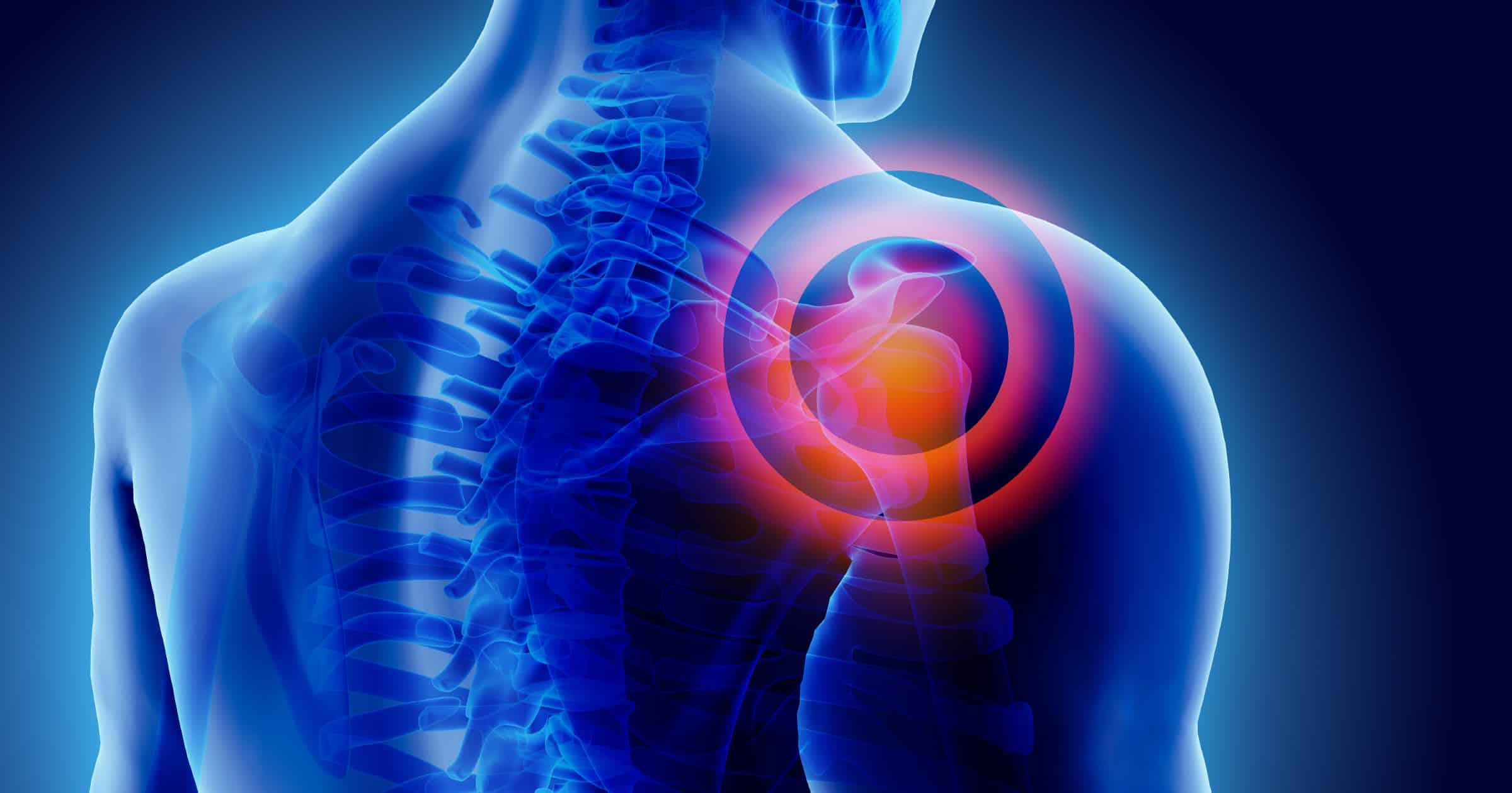 Cooper Clinic Physicians on Supplements That Help Fight Chronic Inflammation