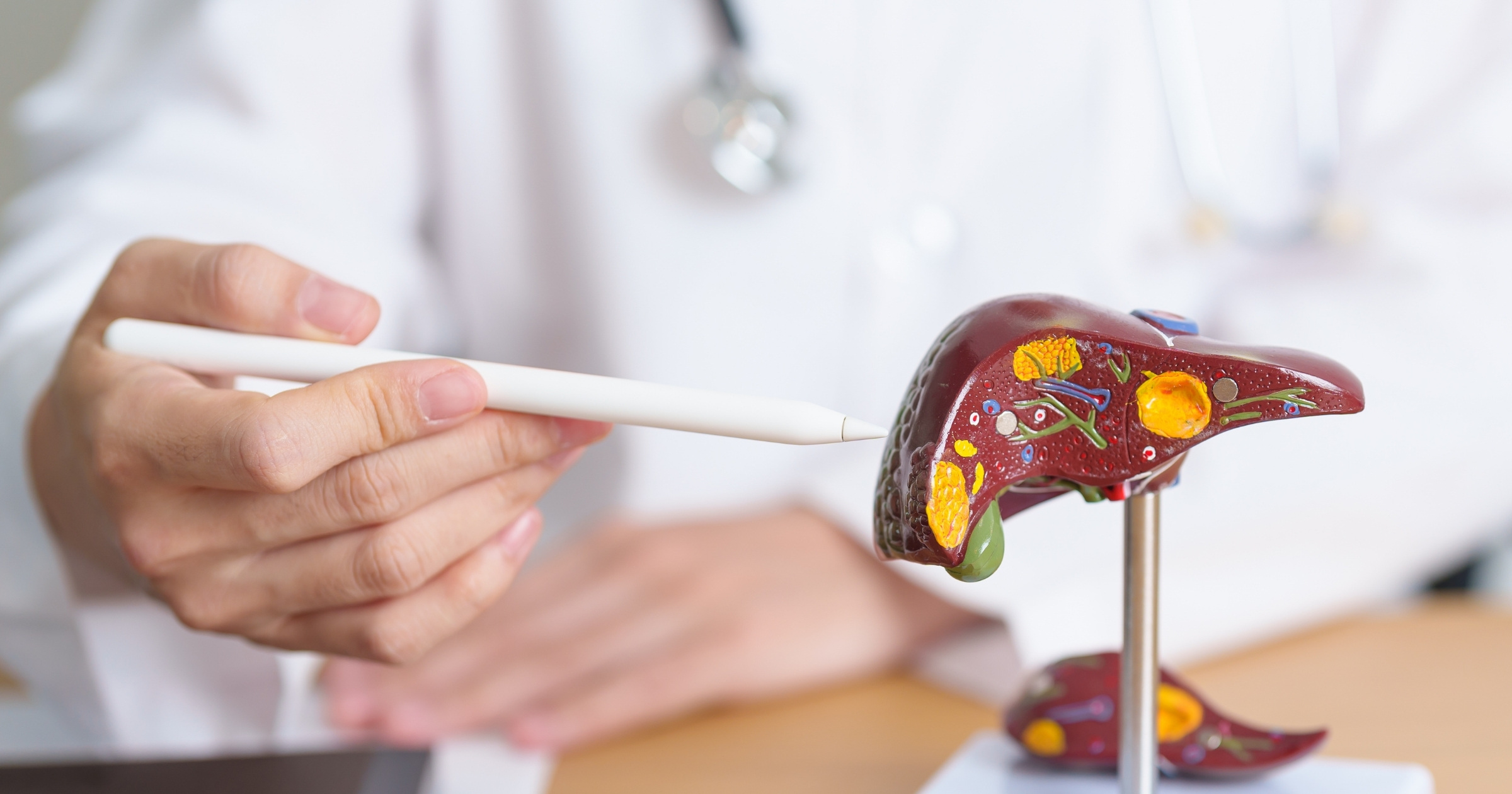 Best Supplements for Fatty Liver Disease